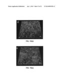 Nanoparticle - Biocide Treatment of Biofilms diagram and image
