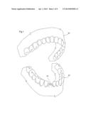 DENTAL IMPLANT POSITIONING SYSTEM diagram and image