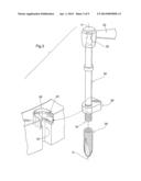 DENTAL IMPLANT POSITIONING SYSTEM diagram and image