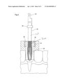 DENTAL IMPLANT POSITIONING SYSTEM diagram and image