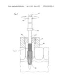 DENTAL IMPLANT POSITIONING SYSTEM diagram and image