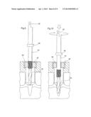 DENTAL IMPLANT POSITIONING SYSTEM diagram and image