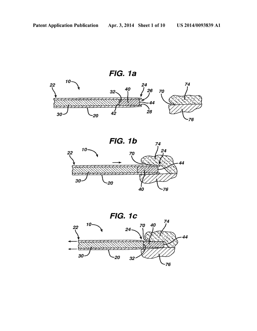 MEDICINAL IMPLANT DEVICE AND CARTRIDGE - diagram, schematic, and image 02