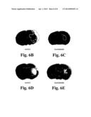 AQUAPORIN MODULATORS AND METHODS OF USING THEM FOR THE TREATMENT OF EDEMA     AND FLUID IMBALANCE diagram and image