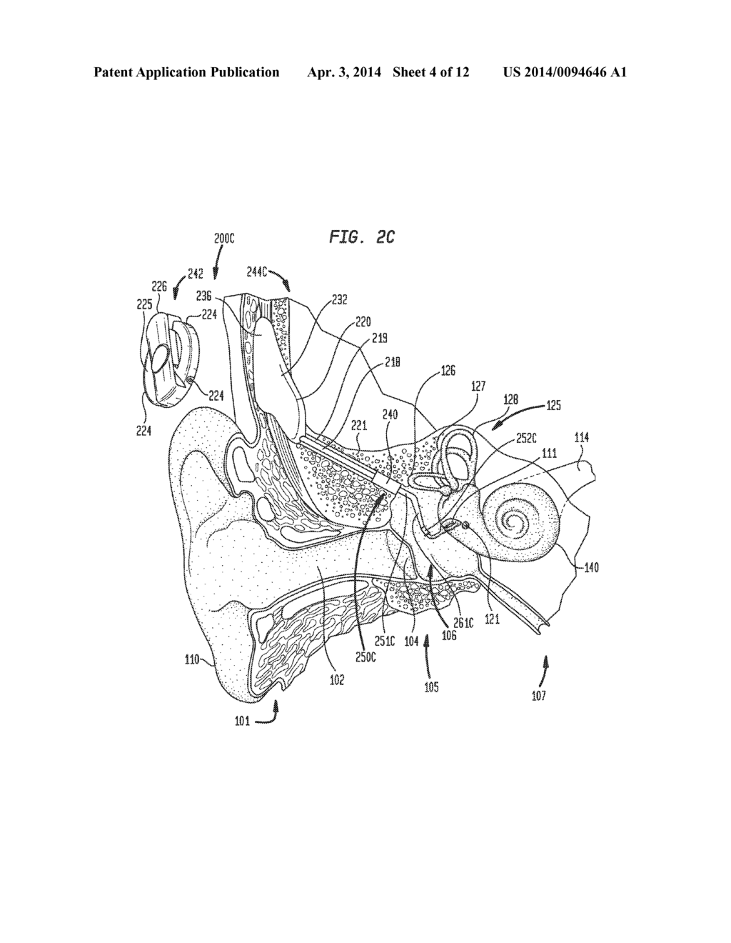 ADJUSTABLE FIXATION DEVICE HAVING REDUCED INFECTION - diagram, schematic, and image 05