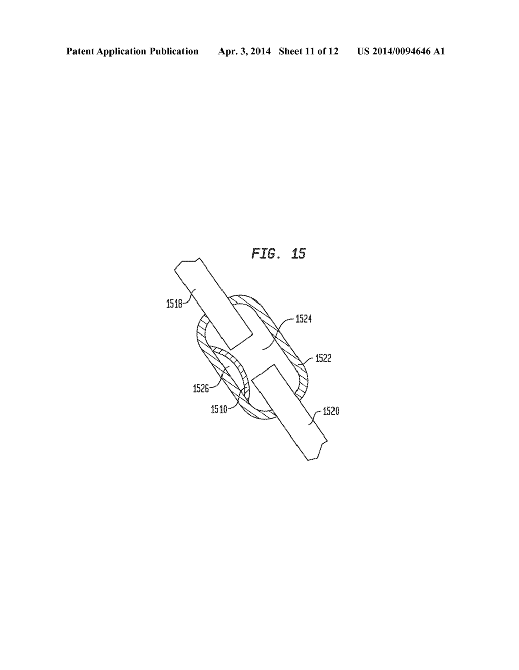 ADJUSTABLE FIXATION DEVICE HAVING REDUCED INFECTION - diagram, schematic, and image 12