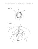 GUIDE SHEATH AND MEDICAL SYSTEM diagram and image