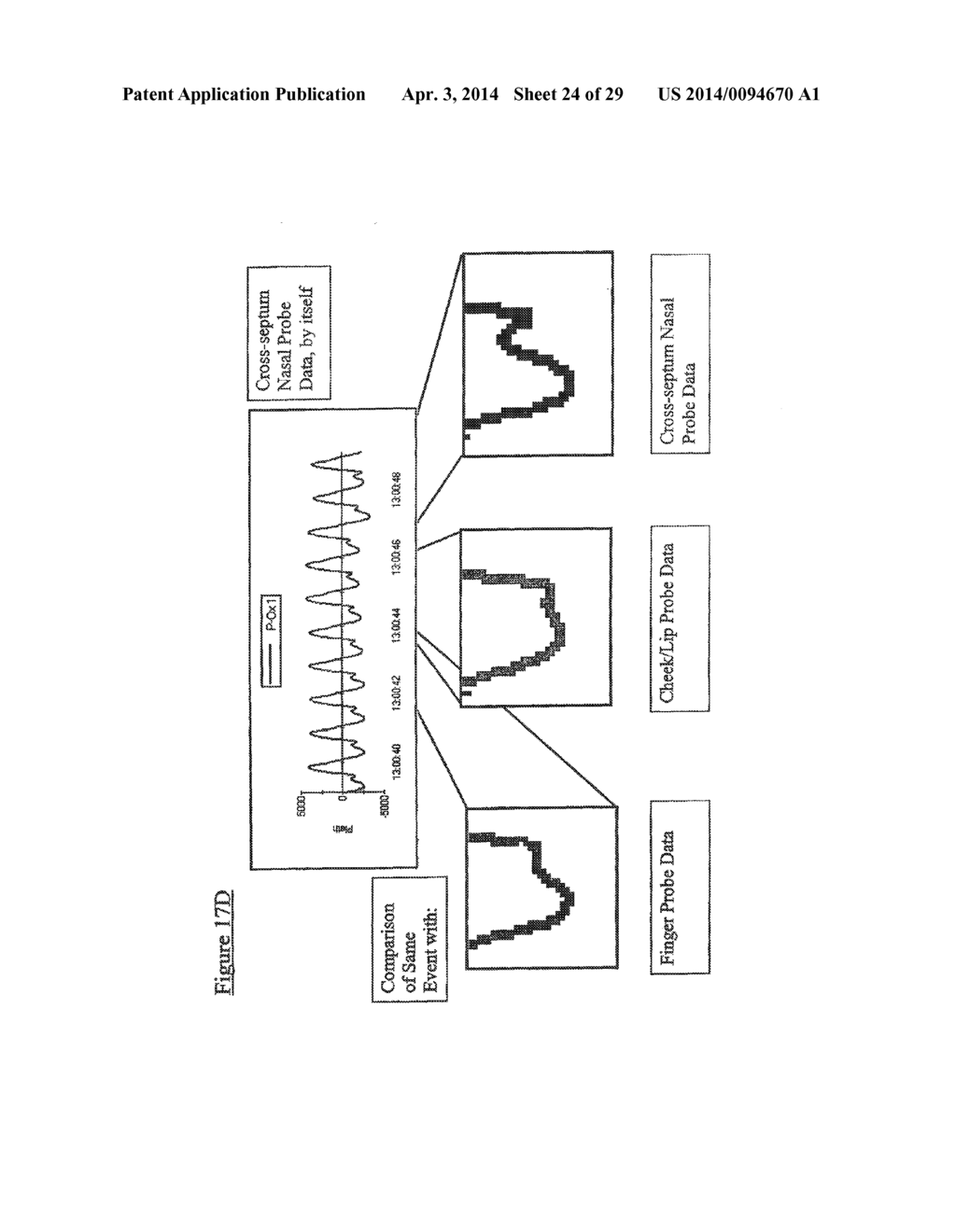 Methods And Systems For Monitoring Respiration With Photoplethysmography - diagram, schematic, and image 25