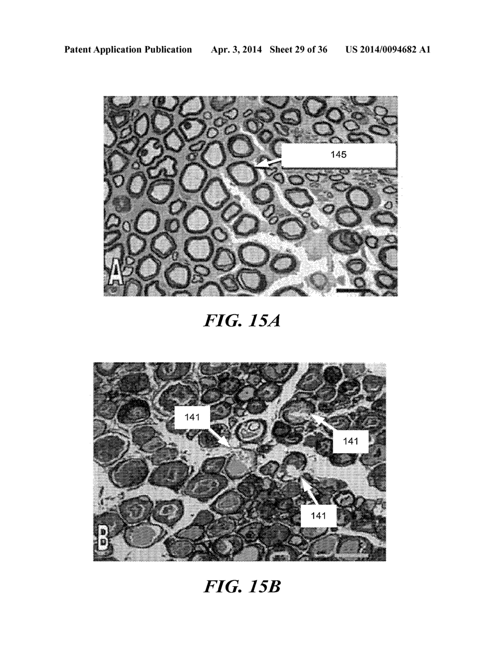 IMAGE GUIDED HIGH INTENSITY FOCUSED ULTRASOUND TREATMENT OF NERVES - diagram, schematic, and image 30