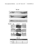 METHODS AND APPARATUSES FOR MEASURING TISSUE STIFFNESS CHANGES USING     ULTRASOUND ELASTICITY IMAGING diagram and image