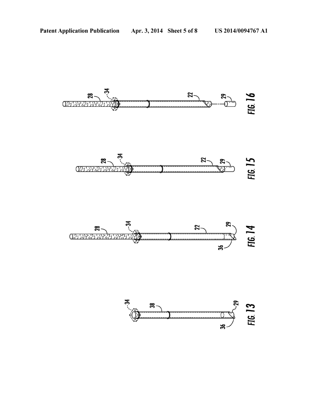 IMPLANT INSERTION SYSTEM - diagram, schematic, and image 06