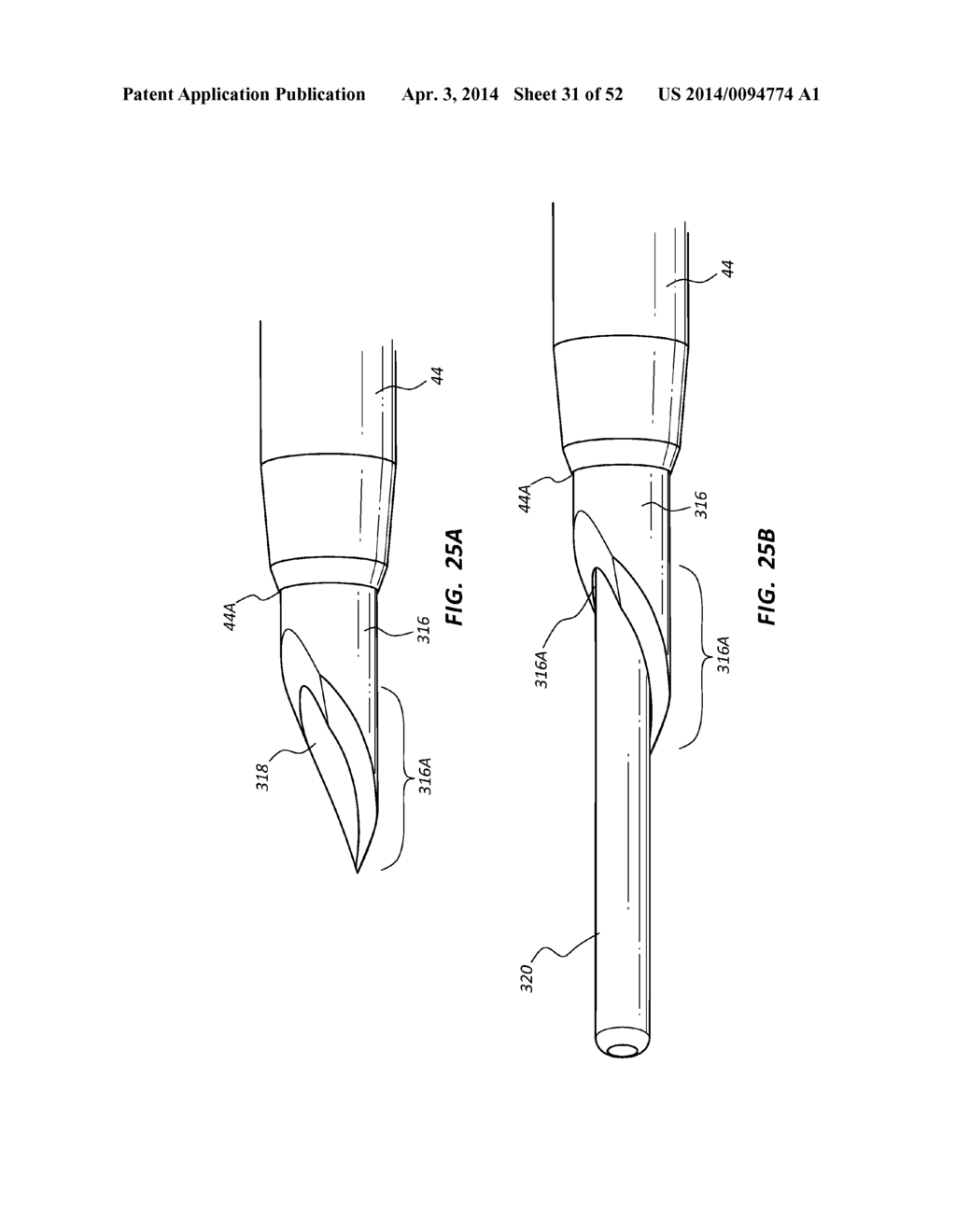 Guidewire Extension System for a Catheter Placement Device - diagram, schematic, and image 32