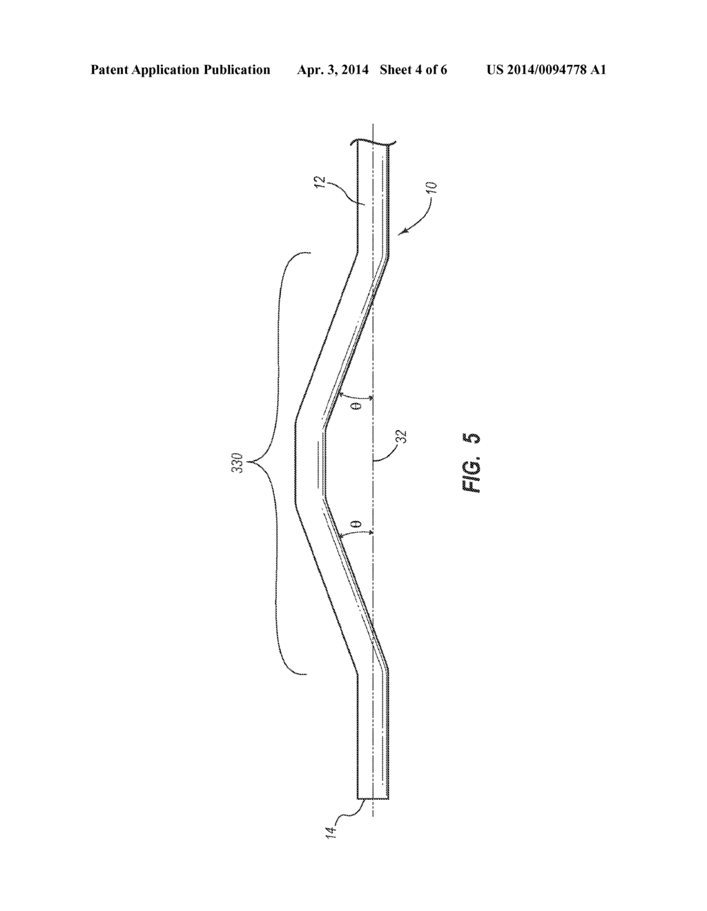 Shape Memory Medical Device and Methods of Use - diagram, schematic, and image 05