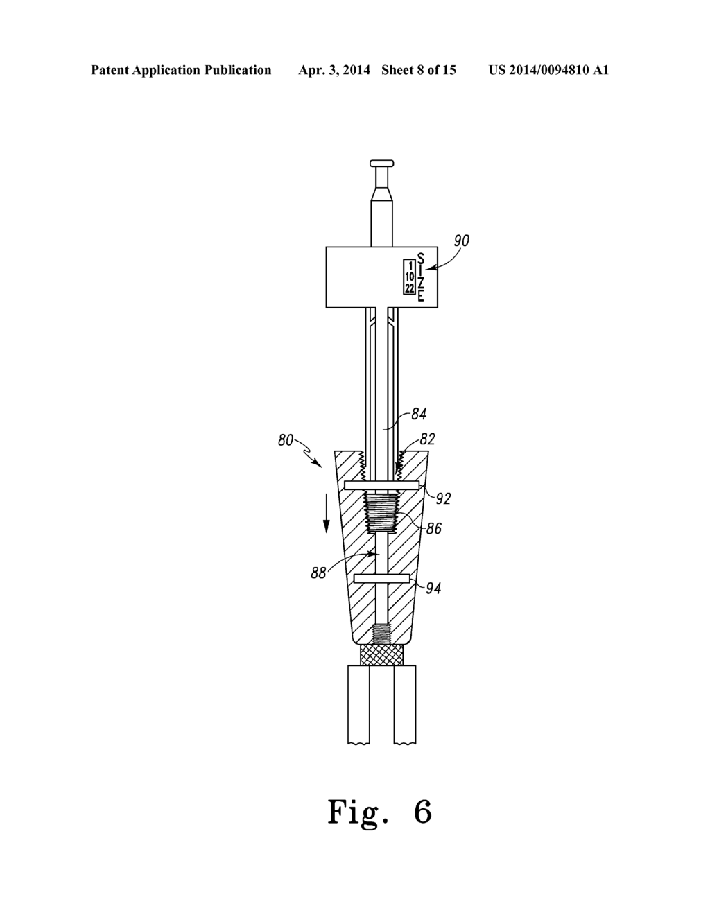 EXPANDABLE PROXIMAL REAMER - diagram, schematic, and image 09