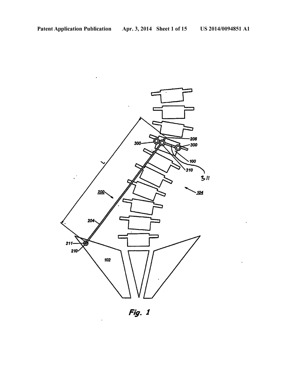 Device and Method for Treatment of Spinal Deformity - diagram, schematic, and image 02