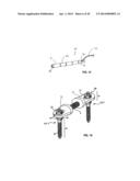 Spinal Stabilization Device diagram and image