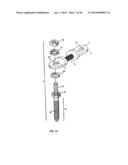 Spinal Stabilization Device diagram and image