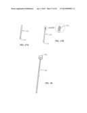 Spinal Stabilization Device diagram and image