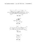 Spinal Stabilization Device diagram and image