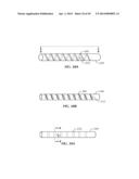 Spinal Stabilization Device diagram and image