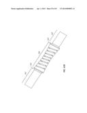 Spinal Stabilization Device diagram and image