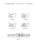 Spinal Stabilization Device diagram and image