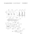 Locking Screws and Plates diagram and image