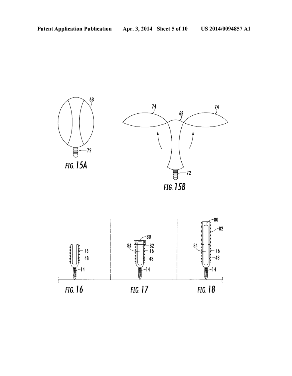 CAM Lock Pedicle Screw - diagram, schematic, and image 06