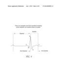 DIASTOLIC CORONARY STENT DEPLOYMENT SYSTEM FOR PRECISE BIFURCATION LESION     STENTING diagram and image