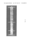 STENT DELIVERY SYSTEM diagram and image