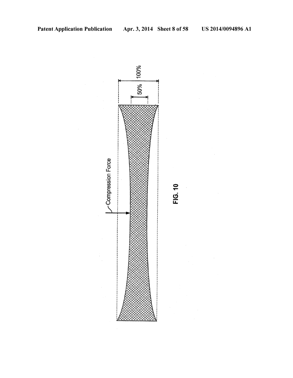 VASCULAR STENTING FOR ANEURYSMS - diagram, schematic, and image 09