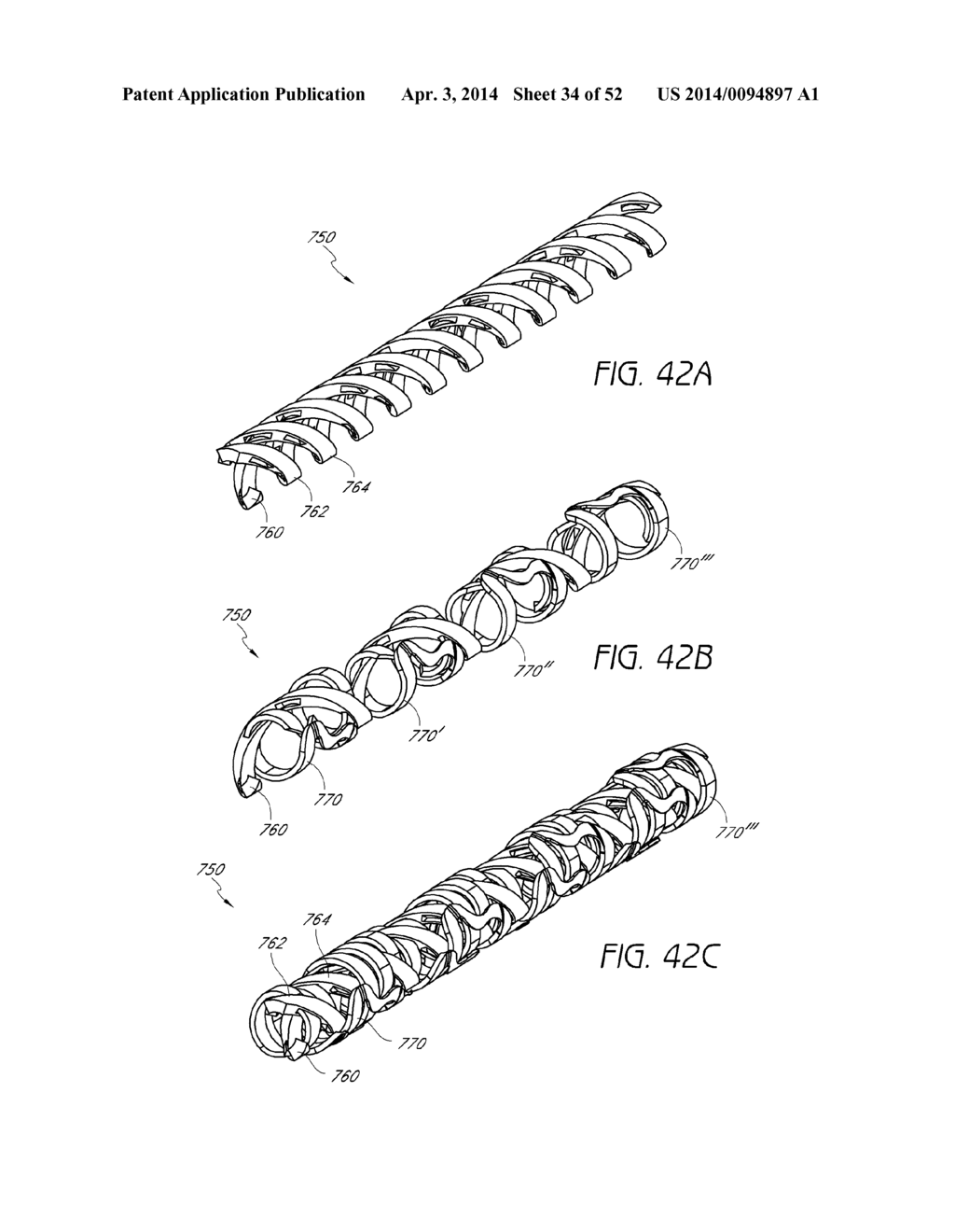 EXPANDABLE SLIDE AND LOCK STENT - diagram, schematic, and image 35