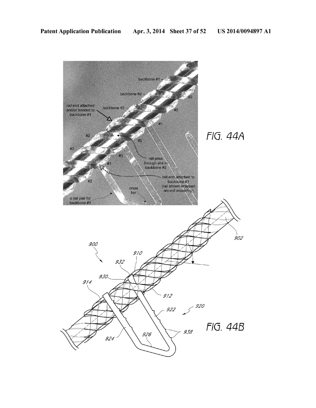 EXPANDABLE SLIDE AND LOCK STENT - diagram, schematic, and image 38