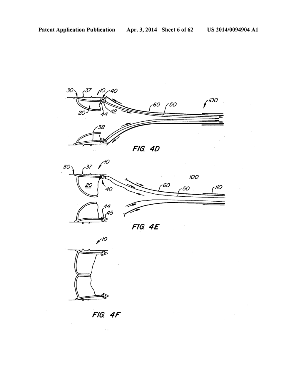 Retrievable Heart Valve Anchor and Method - diagram, schematic, and image 07