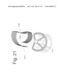 BONE FIXATION AND FUSION DEVICE diagram and image