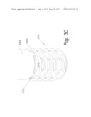 BONE FIXATION AND FUSION DEVICE diagram and image