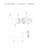 BONE FIXATION AND FUSION DEVICE diagram and image