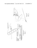 Multi-Capture Mode Wave Energy Converter With Submergible Float diagram and image