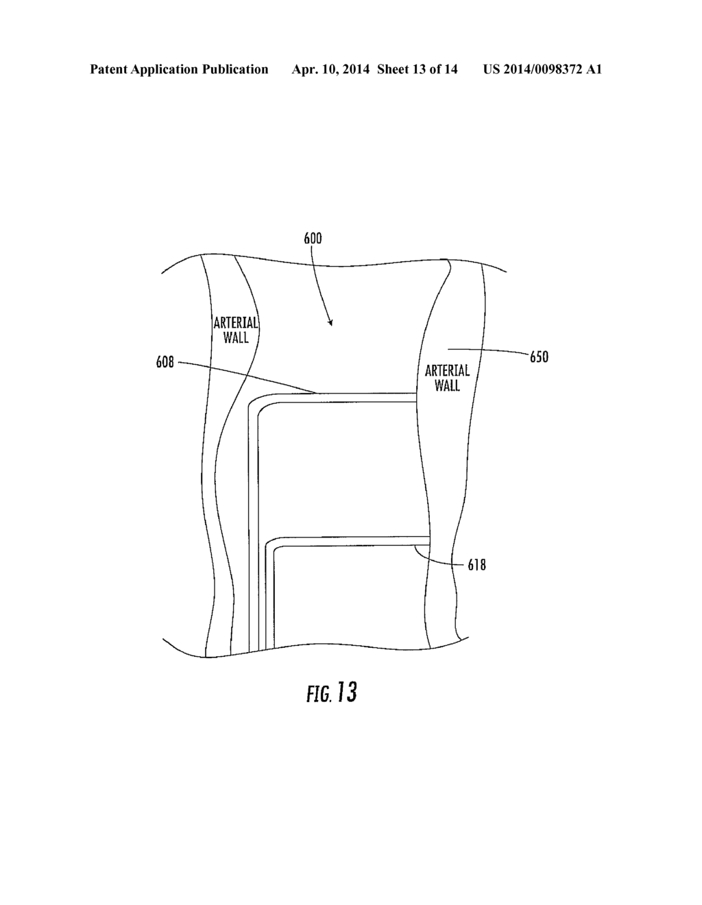 INTERFEROMETRIC SENSING APPARATUS INCLUDING ADJUSTABLE COUPLING AND     ASSOCIATED METHODS - diagram, schematic, and image 14