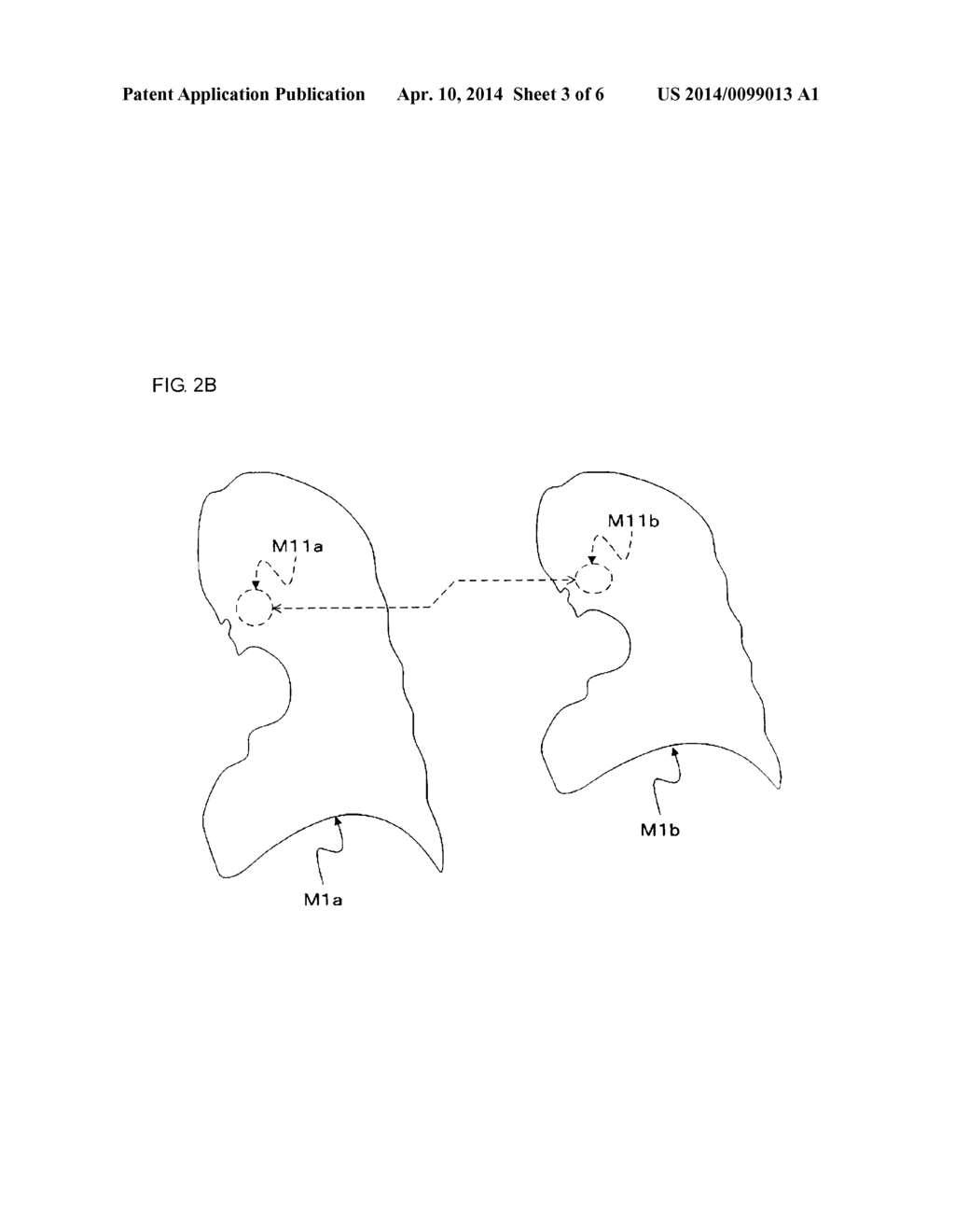 MEDICAL IMAGE-PROCESSING APPARATUS, X-RAY CT APPARATUS, AND A MEDICAL     IMAGE-PROCESSING METHOD - diagram, schematic, and image 04