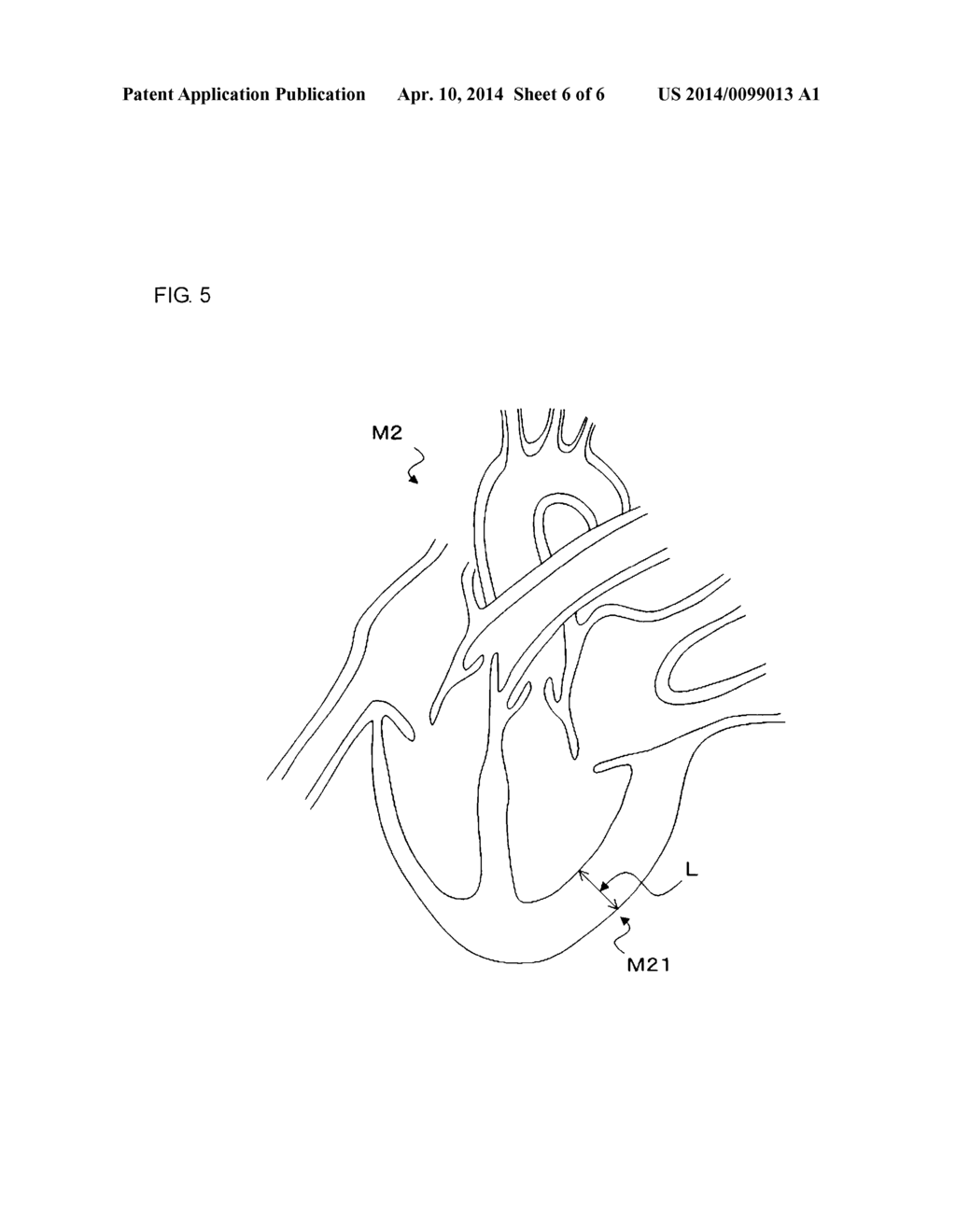 MEDICAL IMAGE-PROCESSING APPARATUS, X-RAY CT APPARATUS, AND A MEDICAL     IMAGE-PROCESSING METHOD - diagram, schematic, and image 07