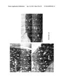 Compositions and Methods for Targeting Stromal Cells for the Treatment of     Cancer diagram and image