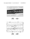 FIBER REINFORCED POLYMER STRENGTHENING SYSTEM diagram and image