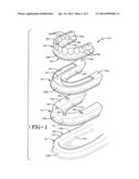 METHOD OF INSTALLING A FINAL DENTAL PROSTHESIS diagram and image