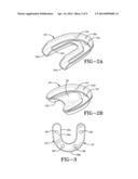 METHOD OF INSTALLING A FINAL DENTAL PROSTHESIS diagram and image