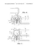 METHOD OF INSTALLING A FINAL DENTAL PROSTHESIS diagram and image