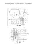 METHOD OF INSTALLING A FINAL DENTAL PROSTHESIS diagram and image