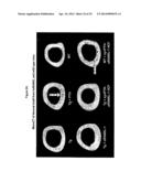 RANKL ANTIBODY-PTH/PTHrP CHIMERIC MOLECULES diagram and image