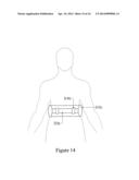 MARKER AND RECOVERY DEVICE diagram and image