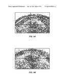 CONNECTIVE TISSUE MONITORING, COMPOSITIONS FOR CONNECTIVE TISSUE TREATMENT     AND METHODS FOR TREATING CONNECTIVE TISSUE diagram and image